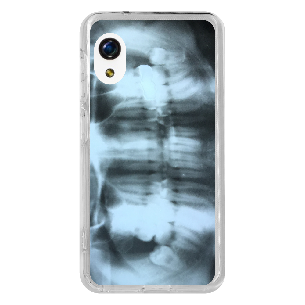 歯形レントゲンケースの商品購入ページ オリジナルプリントグッズ販売のオリラボマーケット